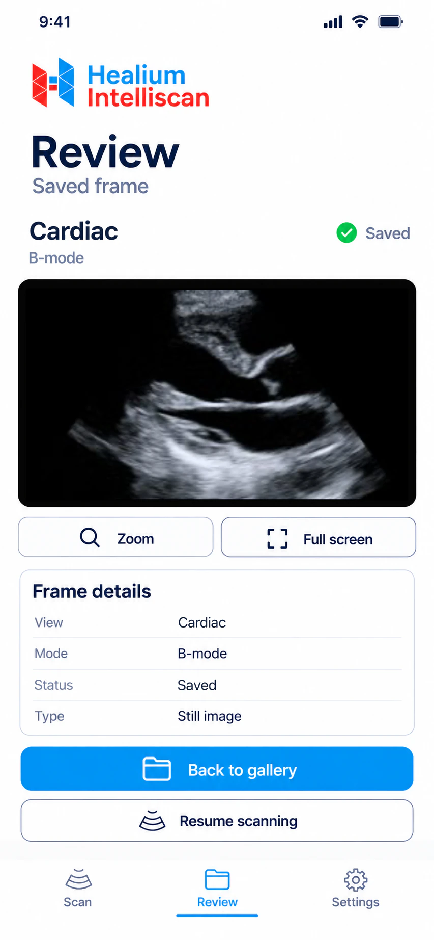 Healium Intelliscan app — Review screen with a saved cardiac frame (B-mode)