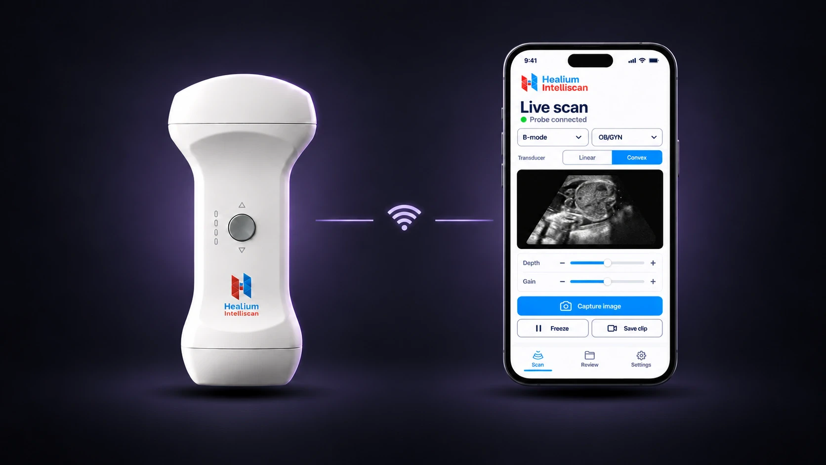 Healium Intelliscan probe beside a phone showing a live OB/GYN scan in the app, connected over direct Wi-Fi